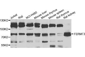 Western blot analysis of extracts of various cells, using FERMT3 antibody. (FERMT3 抗体)