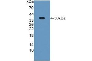 Detection of Recombinant Plg, Rat using Polyclonal Antibody to Plasminogen (Plg) (PLG 抗体  (AA 191-433))