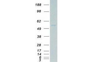 Western Blotting (WB) image for Megakaryocyte-Associated tyrosine Kinase (MATK) (Transcript Variant 3) protein (Myc-DYKDDDDK Tag) (ABIN2725548)