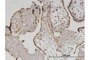 Image no. 4 for anti-Helicase with Zinc Finger (HELZ) (AA 1-101) antibody (ABIN599500) (HELZ 抗体  (AA 1-101))
