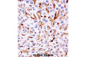 Immunohistochemistry (IHC) image for anti-Mitogen-Activated Protein Kinase 11 (MAPK11) antibody (ABIN2997621) (MAPK11 抗体)