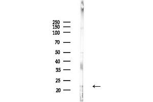 Western blot analysis of lysates from Hela cells(UV,30 min treatment), using SIVA Antibody at 1/1000 dilution.