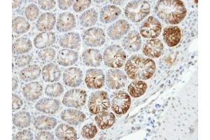 IHC-P Image Immunohistochemical analysis of paraffin-embedded human small intestine, using MST4, antibody at 1:100 dilution. (STK26/MST4 抗体  (C-Term))