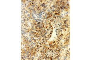 Anti-Annexin VI antibody, IHC(F) IHC(F): Rat Spleen Tissue (ANXA6 抗体  (C-Term))