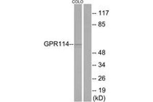 Western blot analysis of extracts from COLO205 cells, using GPR114 Antibody. (GPR114 抗体  (AA 91-140))