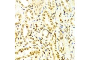 Immunohistochemistry of paraffin-embedded human kidney using DKC1 Antibody (ABIN5970956) at dilution of 1/100 (40x lens). (DKC1 抗体)