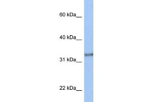 WB Suggested Anti-ACBD4 Antibody Titration:  0. (ACBD4 抗体  (N-Term))