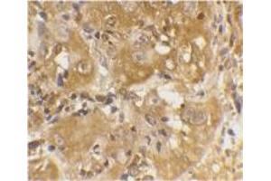 Image no. 1 for anti-BCL2-Like 11 (Apoptosis Facilitator) (BCL2L11) (Internal Region) antibody (ABIN201915) (BIM 抗体  (Internal Region))