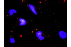 Proximity Ligation Assay (PLA) image for anti-Endoplasmic Reticulum To Nucleus Signaling 1 (ERN1) (AA 401-500) antibody (ABIN560791)