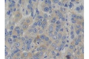 Immunohistochemistry (IHC) image for anti-Tryptophanyl-tRNA Synthetase (WARS) (AA 247-458) antibody (ABIN7441784)