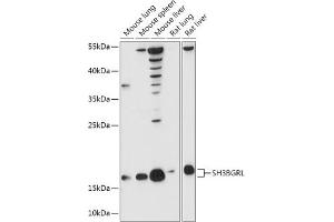 Western blot analysis of extracts of various cell lines, using SH3BGRL antibody (ABIN7270277) at 1:1000 dilution. (SH3BGRL 抗体  (AA 1-114))