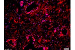 Formalin-fixed and paraffin embedded human lung labeled with Anti-CD162 Polyclonal Antibody, Unconjugated (ABIN679298) at 1:200 followed by conjugation to the secondary antibody Goat Anti-Rabbit IgG, Cy3 conjugated used at 1:200 dilution for 40 minutes at 37°C and DAPI staining (SELPLG 抗体  (AA 251-350))