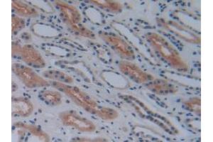 Detection of COX-1 in Human Kidney Tissue using Polyclonal Antibody to Cyclooxygenase 1 (COX-1) (COX-1 抗体  (AA 367-599))