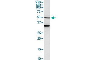 EEF1A1 polyclonal antibody (A01). (eEF1A1 抗体  (AA 156-255))