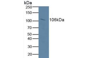 Figure. (Retinoblastoma 1 抗体  (AA 639-778))