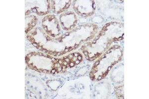 Immunohistochemistry of paraffin-embedded rat kidney using GLUD1 Rabbit pAb (ABIN6127975, ABIN6141157, ABIN6141158 and ABIN6223546) at dilution of 1:100 (40x lens). (GLUD1 抗体  (AA 54-240))