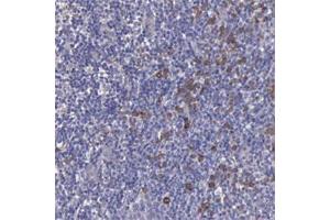 Immunohistochemical staining of human tonsil with ZC3H12B polyclonal antibody  shows distinct cytoplasmic positivity in subsets of cells.