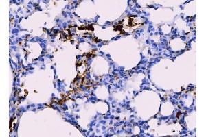 IHC analysis of Integrin beta 3/ITGB3 using anti-Integrin beta 3/ITGB3 antibody (ABIN7601139).