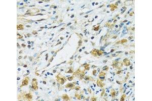 Immunohistochemistry (Paraffin-embedded Sections) (IHC (p)) image for anti-Ribosomal Protein S7 (RPS7) antibody (ABIN7262639)