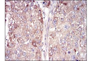 Immunohistochemistry (IHC) image for anti-Vitronectin (VTN) (AA 20-199) antibody (ABIN5542595)