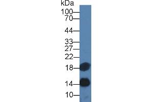 Western Blot; Sample: Human Serum; Primary Ab: 3µg/ml Mouse Anti-Human SAA Antibody Second Ab: 0. (CST3 抗体  (AA 27-146))