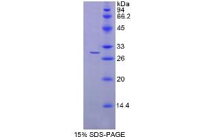 SDS-PAGE analysis of Human NAAA Protein.