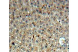 Used in DAB staining on fromalin fixed paraffin-embedded Liver tissue (INHBE 抗体  (AA 102-344))