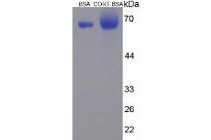 Image no. 2 for Corticosterone (CORT) protein (BSA) (ABIN1880178) (Corticosterone Protein (CORT) (BSA))