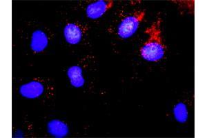 Proximity Ligation Analysis of protein-protein interactions between MYBL2 and RBL1. (p107 抗体  (AA 905-1014))