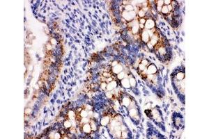 Peroxiredoxin 3 antibody and rat intestine tissue tested by IHC-P (Peroxiredoxin 3 抗体  (AA 239-256))