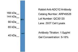 WB Suggested Anti-ADCY2  Antibody Titration: 0.