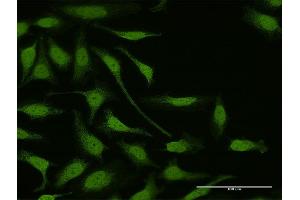 Immunofluorescence of purified MaxPab antibody to LIMK1 on HeLa cell. (LIM Domain Kinase 1 抗体  (AA 1-647))