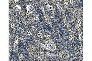 IHC analysis of ATP6V1A using anti-ATP6V1A antibody (ABIN7599916).