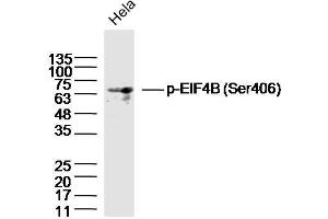 HeLa lysates probed with EIF4B (Ser406) Polyclonal Antibody, Unconjugated  at 1:300 dilution and 4˚C overnight incubation. (EIF4B 抗体  (pSer406))