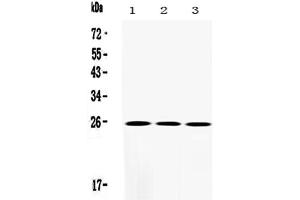 Western blot analysis of SOD2/Mnsod using anti-SOD2/Mnsod antibody . (SOD2 抗体  (N-Term))