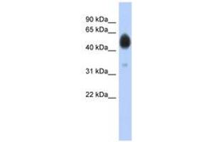 Image no. 1 for anti-Arylsulfatase A (ARSA) (AA 37-86) antibody (ABIN6743778) (Arylsulfatase A 抗体  (AA 37-86))