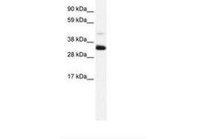 Image no. 2 for anti-Annexin A3 (ANXA3) (N-Term) antibody (ABIN202243) (Annexin A3 抗体  (N-Term))