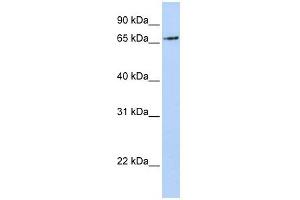 RNF139 antibody used at 1 ug/ml to detect target protein.