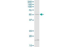 TUBB1 MaxPab rabbit polyclonal antibody. (TUBB1 抗体  (AA 1-451))