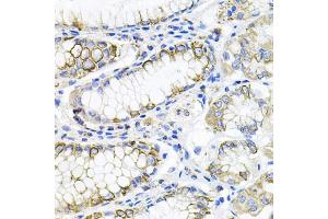 Immunohistochemistry of paraffin-embedded human stomach using ACVR2A antibody (ABIN5971030) at dilution of 1/100 (40x lens). (ACVR2A 抗体)