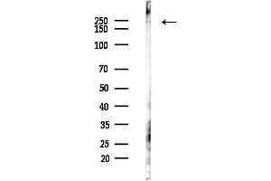 anti-Proteasome (Prosome, Macropain) Activator Subunit 4 (PSME4) (C-Term) antibody