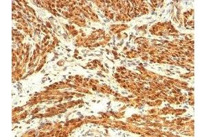 Formalin-fixed, paraffin-embedded human uterus stained with Calponin antibody (CNN1/832 + CALP). (Calponin 抗体)