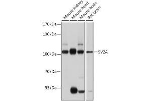 Western blot analysis of extracts of various cell lines, using SV2A antibody (ABIN7270665) at 1:1000 dilution. (SV2A 抗体  (AA 356-447))