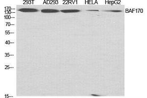 Western Blotting (WB) image for anti-SWI/SNF Related, Matrix Associated, Actin Dependent Regulator of Chromatin, Subfamily C, Member 2 (SMARCC2) (Internal Region) antibody (ABIN3183467)