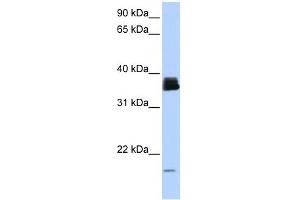 PPIA antibody used at 1 ug/ml to detect target protein. (PPIA 抗体)