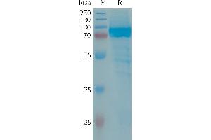 Human IL13RA2 Protein, hFc Tag on SDS-PAGE under reducing condition.