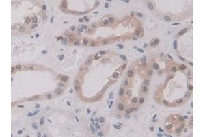 Immunohistochemistry (IHC) image for anti-Annexin A11 (ANXA11) (AA 1-505) antibody (ABIN7435868)