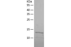 PTRHD1 Protein (AA 1-140) (His tag)