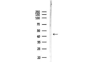 anti-Epoxide Hydrolase 4 (EPHX4) (Internal Region) antibody
