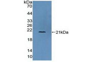 Detection of Recombinant COL6a3, Human using Polyclonal Antibody to Collagen Type VI Alpha 3 (COL6a3) (COL6a3 抗体  (AA 463-624))